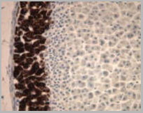product-image-AAA14663_IHC.jpg
