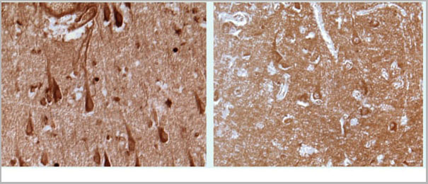 product-image-AAA14721_IHC.jpg