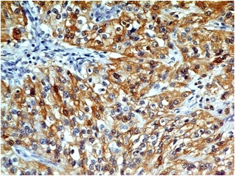 product-image-AAA14862_IHC3.jpg