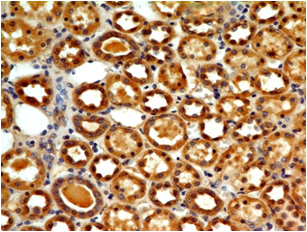 product-image-AAA14863_IHC.jpg