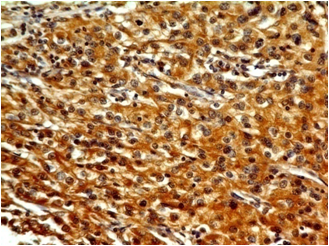 product-image-AAA14863_IHC3.jpg