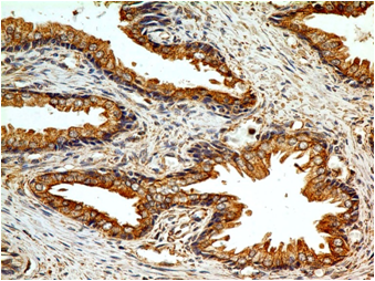 product-image-AAA14864_IHC4.jpg