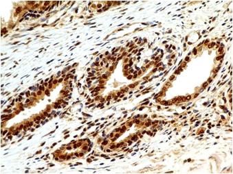 product-image-AAA14866_IHC5.jpg