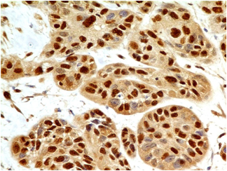 product-image-AAA14866_IHC6.jpg