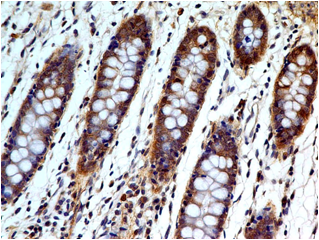 product-image-AAA14867_IHC2.jpg