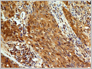 product-image-AAA14867_IHC5.jpg