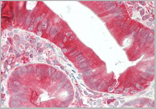 product-image-AAA14867_IHC6.jpg