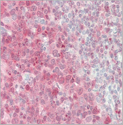 product-image-AAA14867_IHC7.jpg