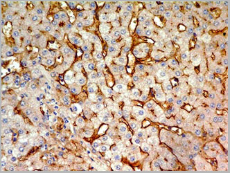 product-image-AAA14868_IHC3.jpg