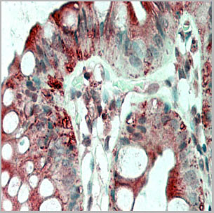 product-image-AAA14869_IHC2.jpg