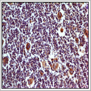 product-image-AAA14873_IHC2.jpg