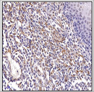 product-image-AAA14873_IHC5.jpg