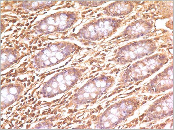 product-image-AAA14884_IHC3.jpg