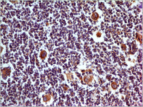product-image-AAA14889_IHC2.jpg