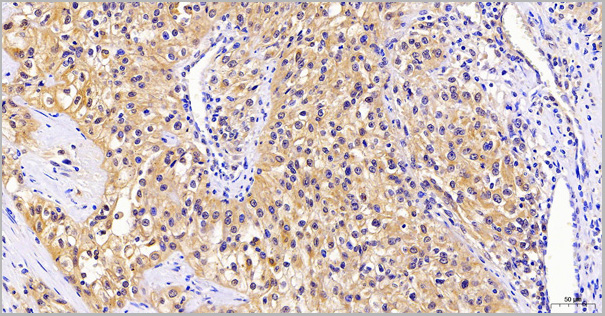 product-image-AAA14890_IHC5.jpg