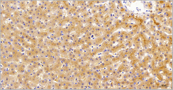 product-image-AAA14890_IHC6.jpg