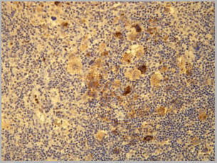 product-image-AAA14933_IHC.jpg