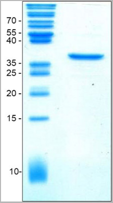 product-image-AAA14946_SDS_PAGE.jpg