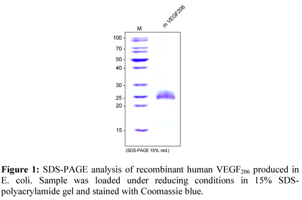 product-image-AAA14948_SDS_PAGE.jpg