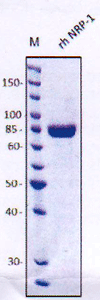 product-image-AAA14949_SDS_PAGE.jpg
