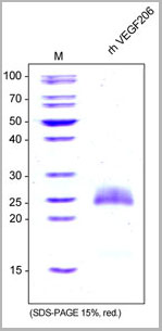 product-image-AAA14955_SDS_PAGE.jpg