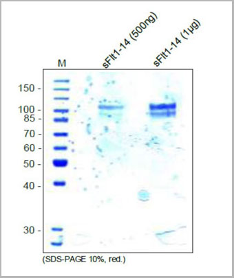 product-image-AAA14956_SDS_PAGE.jpg