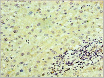 product-image-AAA15913_IHC2.jpg