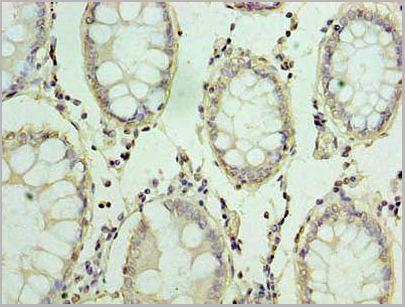 product-image-AAA15913_IHC3.jpg