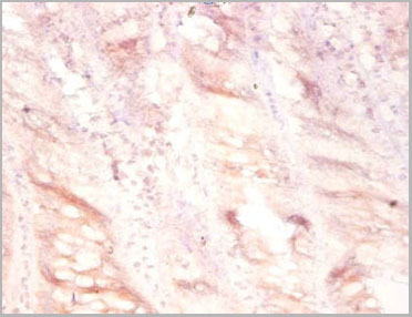 product-image-AAA15951_IHC2.jpg