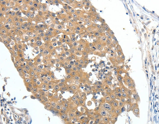 product-image-AAA167363_IHC15.jpg