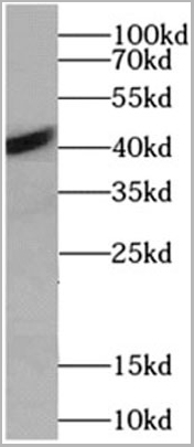 product-image-AAA17777_SDS_PAGE2.jpg