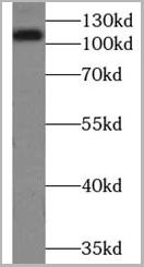 product-image-AAA17778_WB.jpg