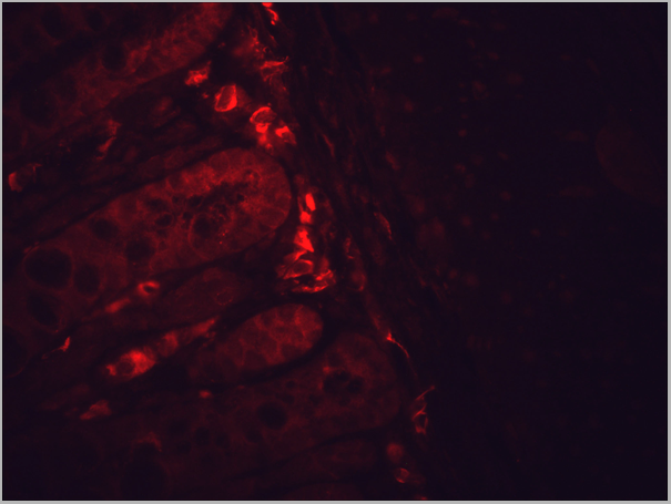 product-image-AAA17785_IHC.png