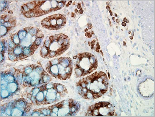product-image-AAA17785_IHC2.png