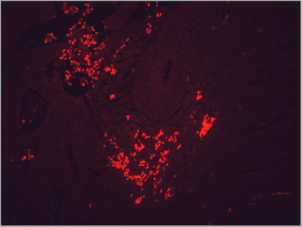 product-image-AAA17785_IHC4.png