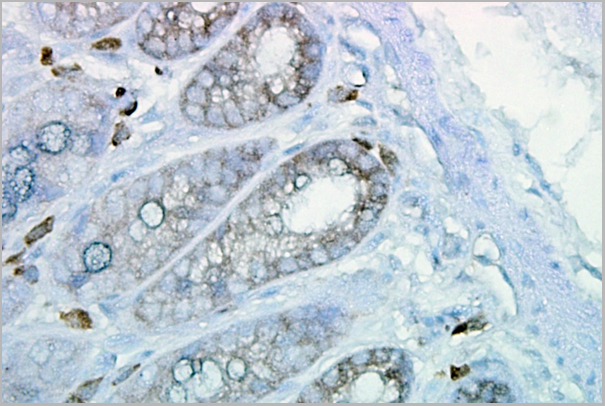 product-image-AAA17785_IHC5.png