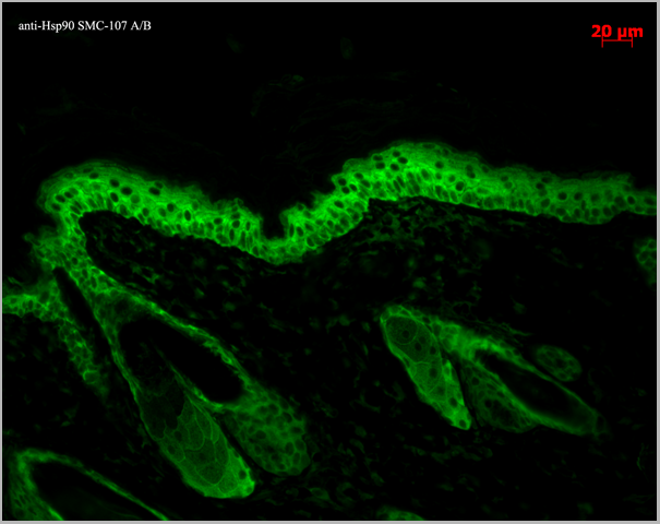 product-image-AAA17785_IHC6.png