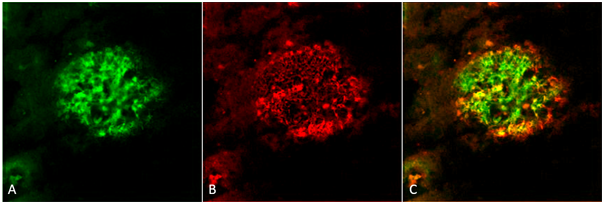 product-image-AAA17799_IHC.png