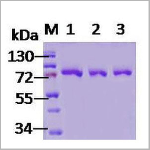 product-image-AAA17805_SDS_PAGE.jpg
