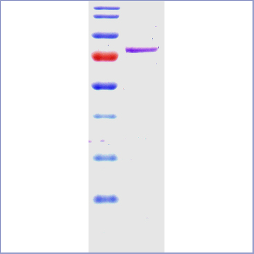 product-image-AAA17807_SDS_PAGE.png