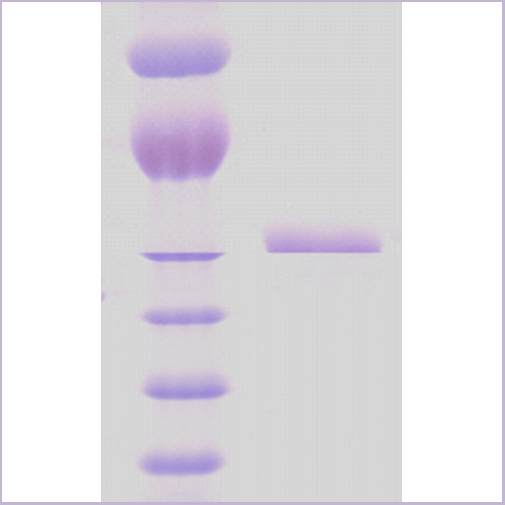 product-image-AAA17808_SDS_PAGE.png