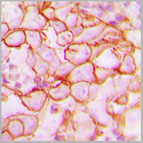product-image-AAA17811_IHC2.jpg