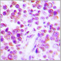 product-image-AAA17812_IHC2.jpg