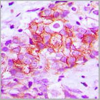product-image-AAA17813_IHC2.jpg