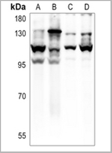 product-image-AAA17813_WB.png