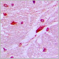 product-image-AAA17814_IHC2.jpg