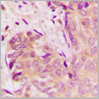 product-image-AAA17815_IHC2.jpg