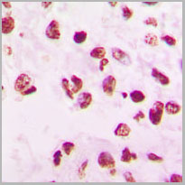 product-image-AAA17818_IHC2.jpg