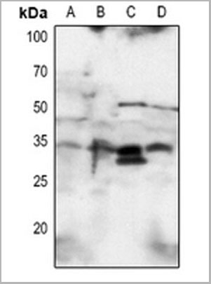product-image-AAA17818_WB.jpg