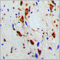 product-image-AAA17819_IHC2.jpg